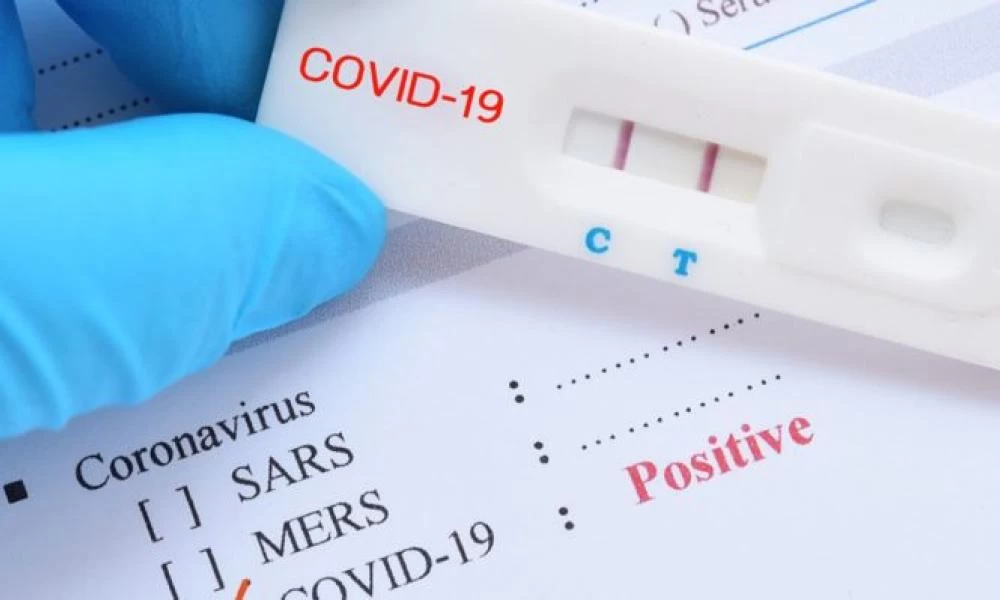 Δωρεάν διάθεση self test: Τελευταία ημέρα η σημερινή